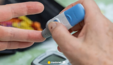 25 mln pacjentów z niezauważaną cukrzycą. Eksperci wskazali nowy typ choroby