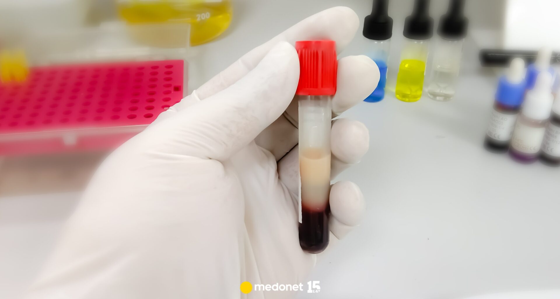 Jak nasze ciało pozbywa się nadmiaru cholesterolu? Te odkrycia przyniosą rewolucję