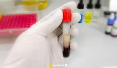 Jak nasze ciało pozbywa się nadmiaru cholesterolu? Te odkrycia przyniosą rewolucję