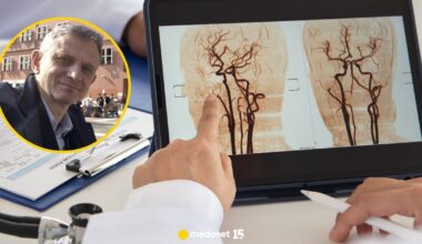 Wysyp udarów mózgu w Polsce. Lekarz: to narastająca fala. Są trzy główne powody - Medonet