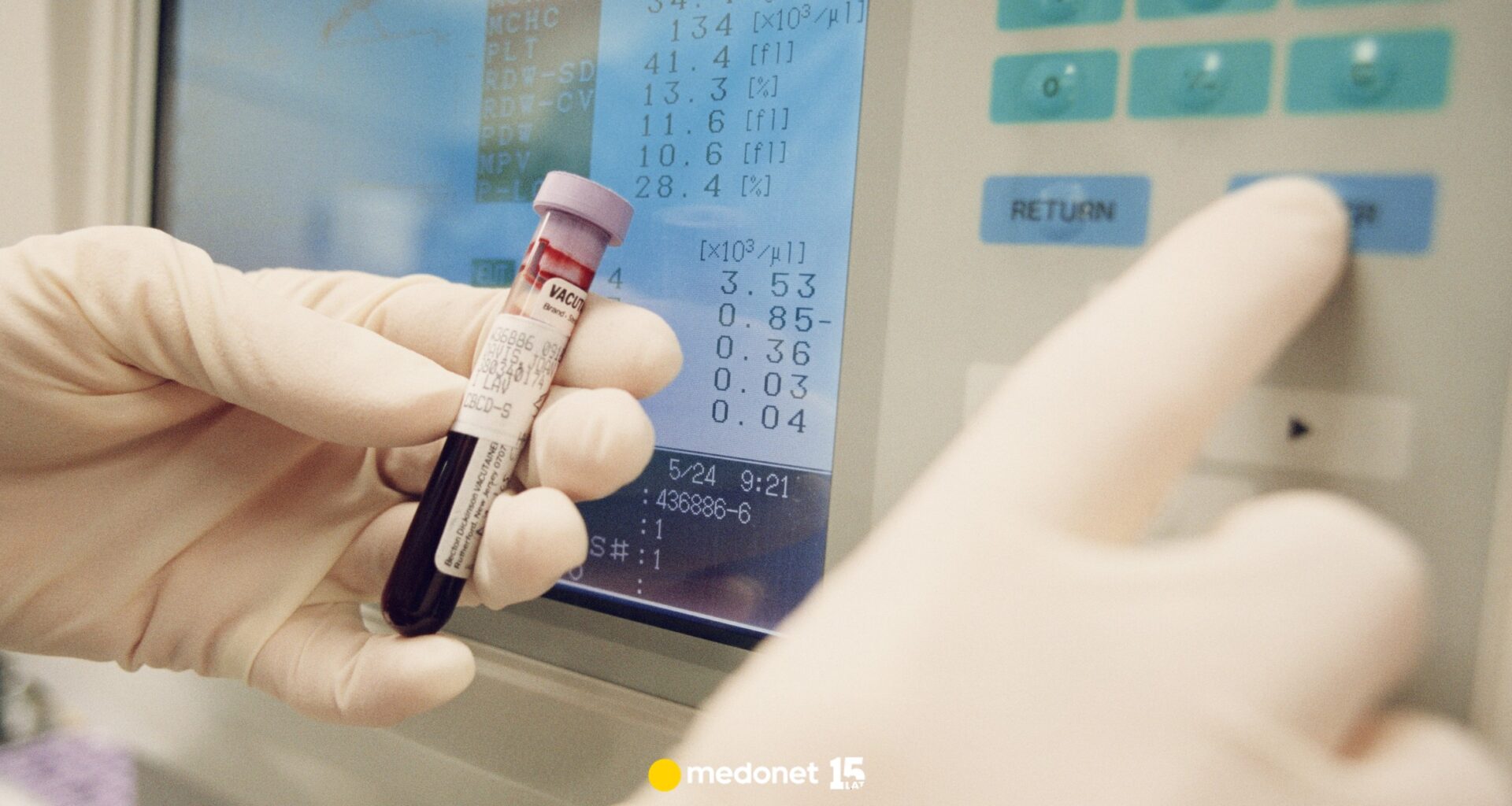 Odkryto niezwykle rzadką grupę krwi. "Hybrydową" krew znaleziono u trzech osób