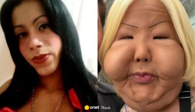 Influencerka chciała poprawić twarz. Teraz walczy, by móc wyglądać normalnie