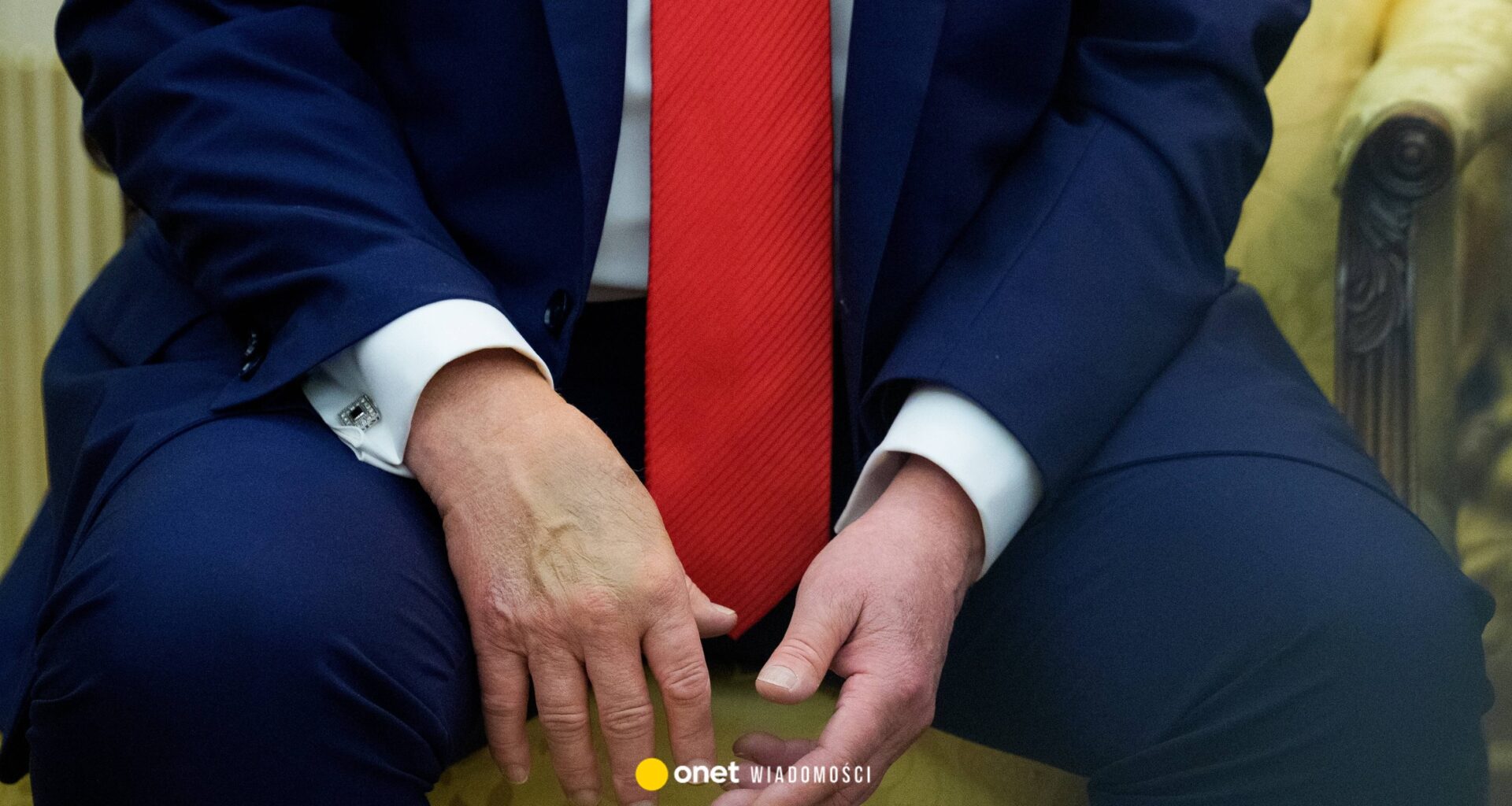 Siniaki na dłoniach Donalda Trumpa. Rzeczniczka Białego Domu podała zaskakujący powód