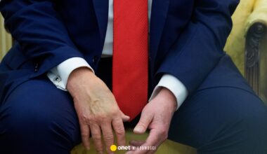Siniaki na dłoniach Donalda Trumpa. Rzeczniczka Białego Domu podała zaskakujący powód