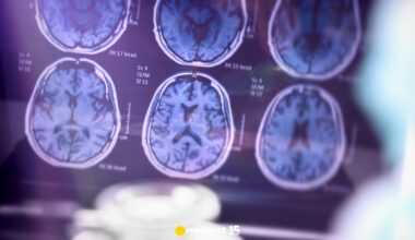 Lek na Alzheimera wchodzi w fazę testów? Nowe odkrycie naukowców