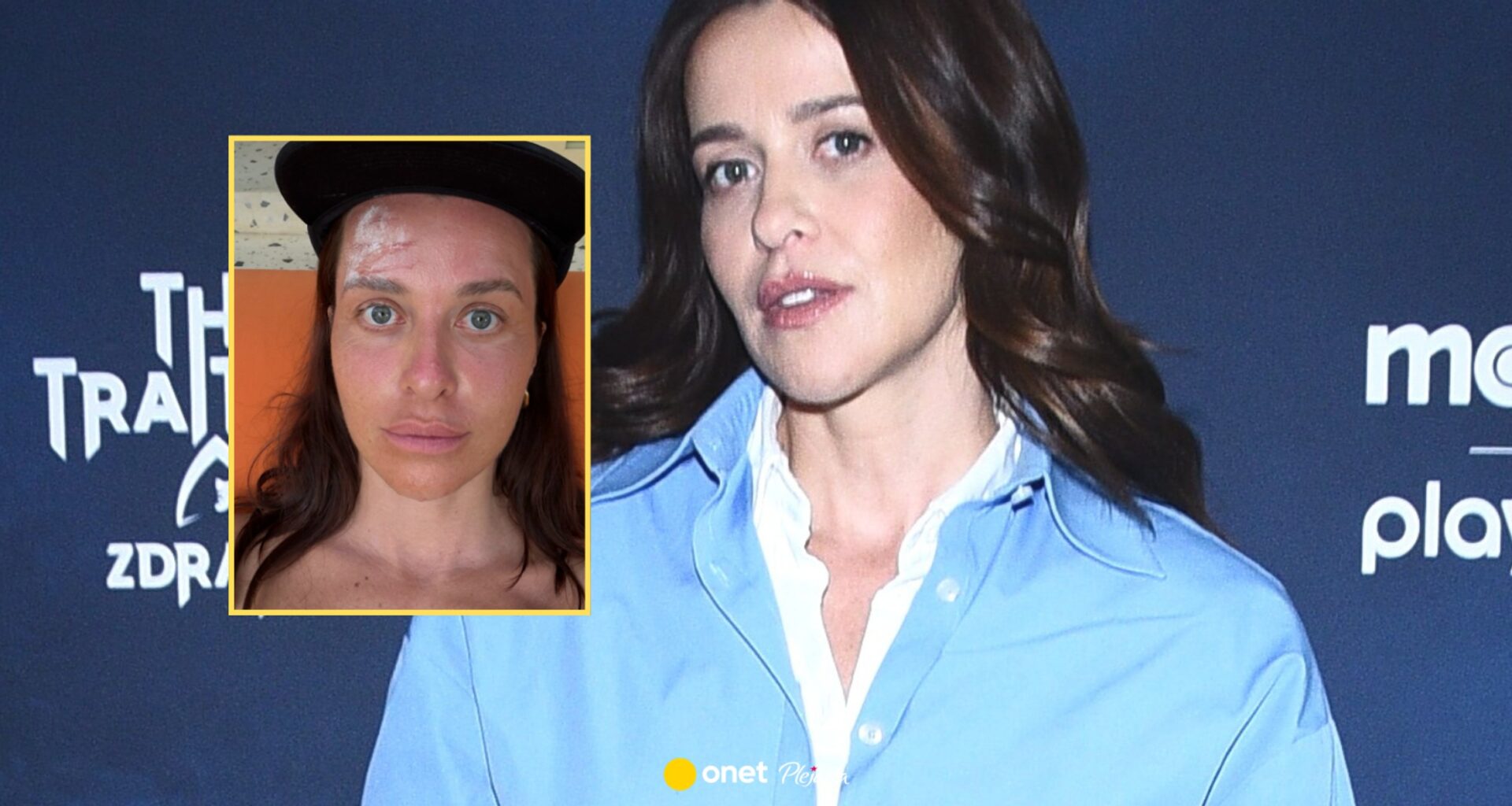 Malwina Wędzikowska miała wypadek na wakacjach. Pokazała, co się stało