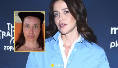 Malwina Wędzikowska miała wypadek na wakacjach. Pokazała, co się stało