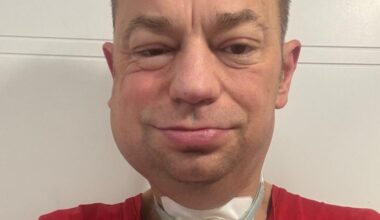 U Sebastiana zdiagnozowano nowotwór złośliwy migdałka. "Od tego czasu moje życie zmieniło się w nieustanną walkę"