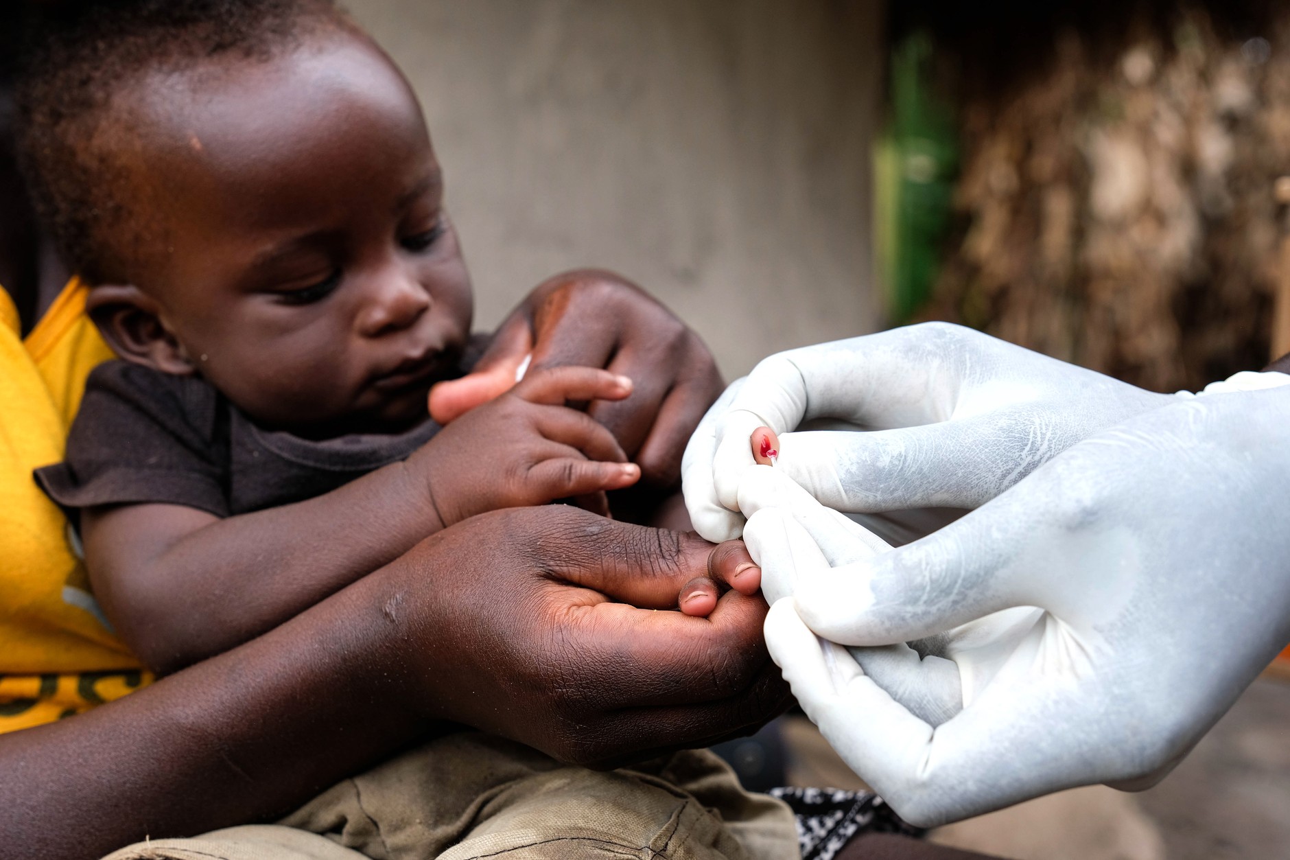 Mały Ugandyjczyk podczas testu na malarię