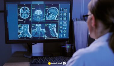 Mózg może wolniej się starzeć. Naukowcy pokazali, co robić