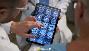 Choroba Alzheimera może być odwracalna. Niesamowite odkrycie z USA