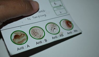 Odkryto najrzadszą grupę krwi. Płynie w żyłach tylko trzech osób. To może martwić