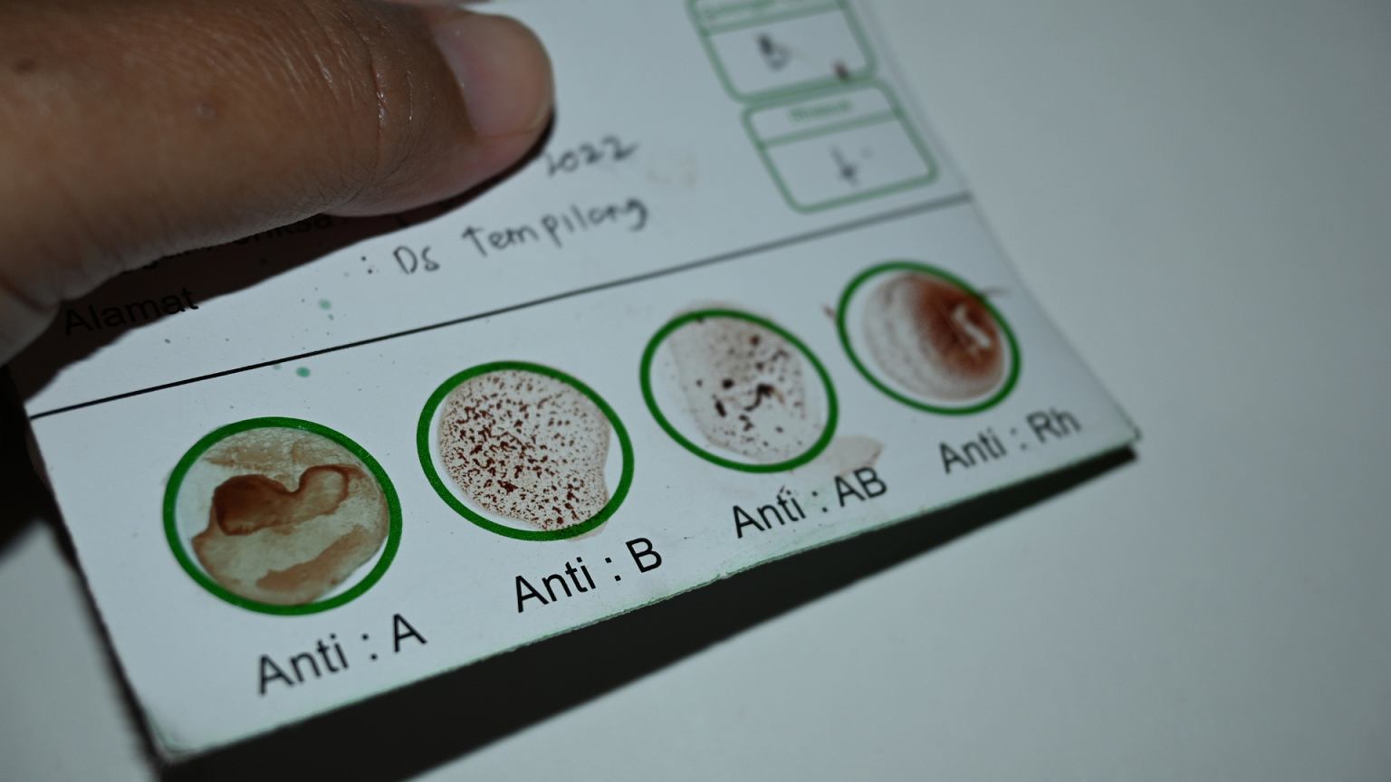 Odkryto najrzadszą grupę krwi. Płynie w żyłach tylko trzech osób. To może martwić