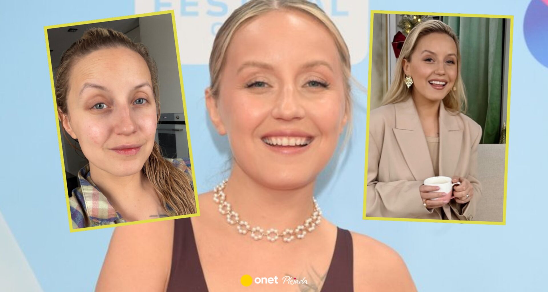 Sandra Hajduk o poddawaniu się operacjom plastycznym. "Taka jest prawda"