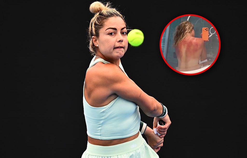 "To nie żart". Tenisistka pokazała przerażające zdjęcie