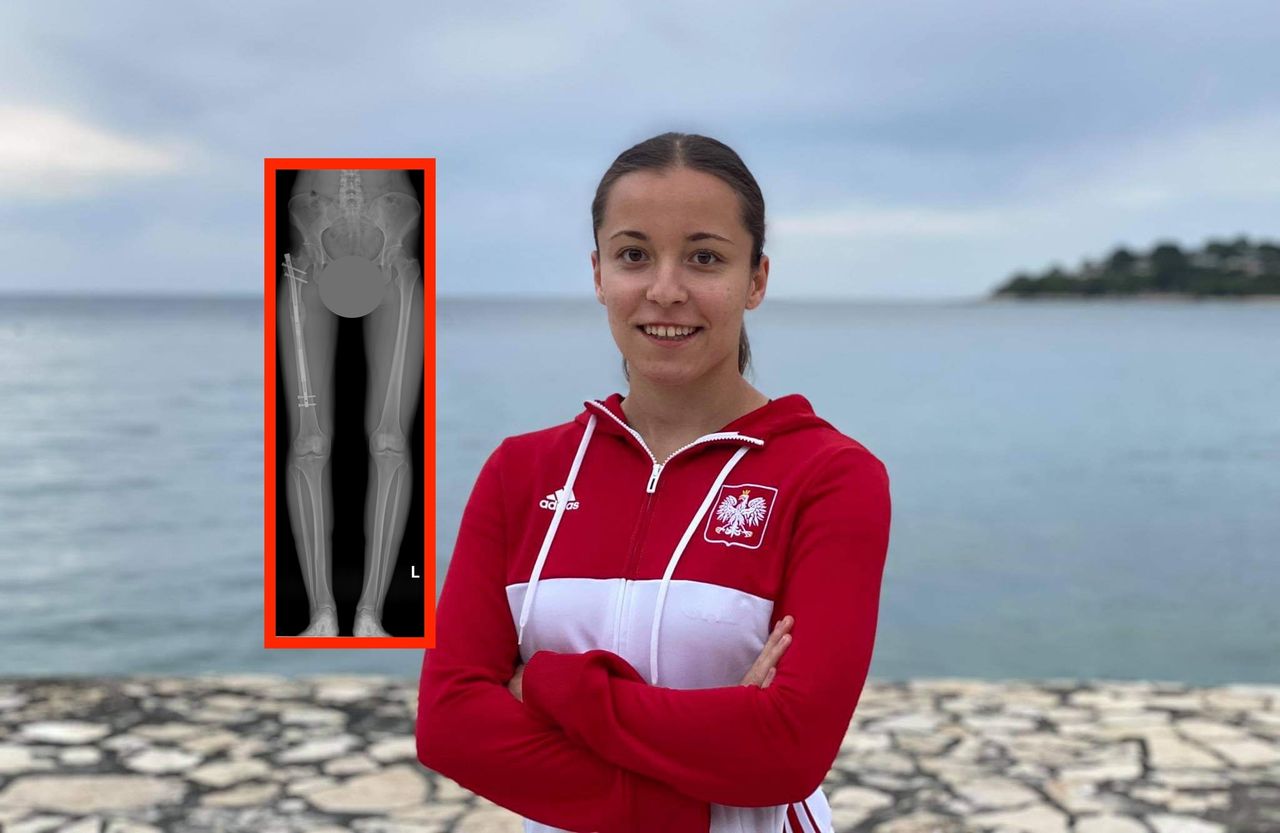 Lekarze nie zauważyli nogi krótszej o 4 cm. Szczęśliwy finał sprawy reprezentantki Polski