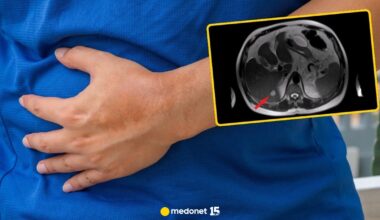 Jak szybko regeneruje się wątroba? Pielęgniarka mówi, jak to wygląda naprawdę