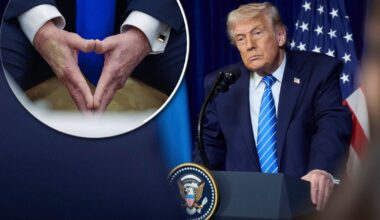 Donald Trump na coś choruje? Tłumaczy się z sinych rąk. Ujawnił prawdę