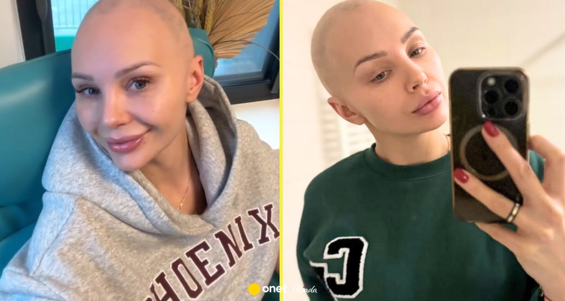 Gwiazda formatu Polsatu zmaga się z rakiem. "Muszę brać zwolnienie"