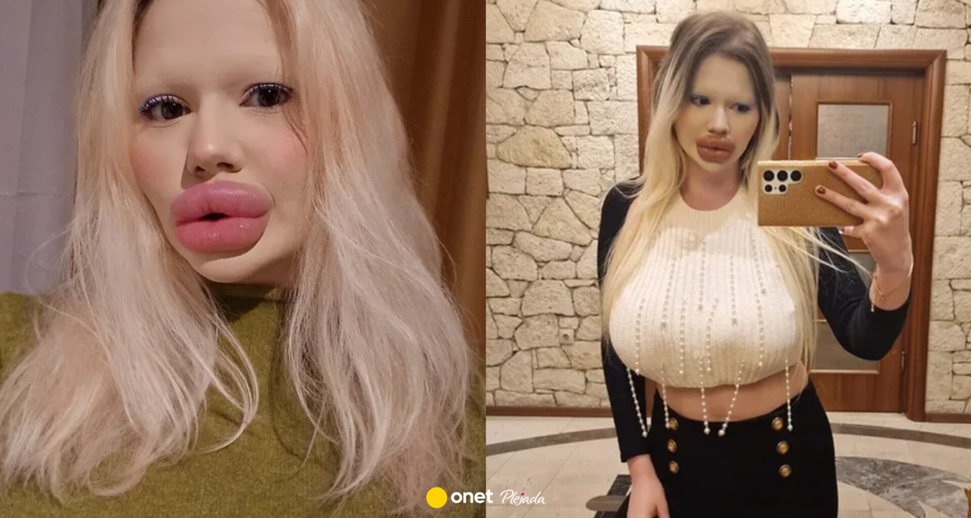 Ma największe usta na świecie. "Bułgarska Barbie" wydała na zabiegi fortunę