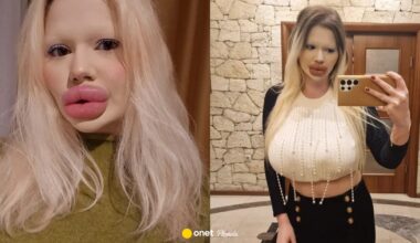 Ma największe usta na świecie. "Bułgarska Barbie" wydała na zabiegi fortunę