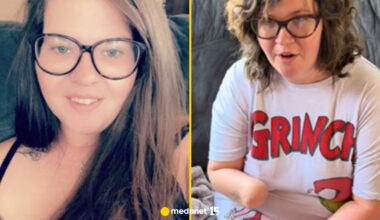 Zasnęła z grypą, obudziła się w szpitalu bez rąk i nóg. Fatalna kombinacja zakażeń