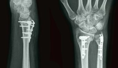 SOR we Włocławku przeżył najgorszy dzień w historii. Padł absolutny rekord