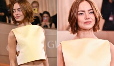 Pytają, co zrobiła sobie z twarzą. Botoks to tylko początek - onet.pl