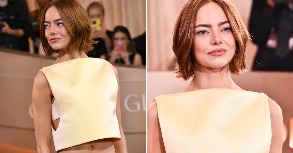 Pytają, co zrobiła sobie z twarzą. Botoks to tylko początek - onet.pl