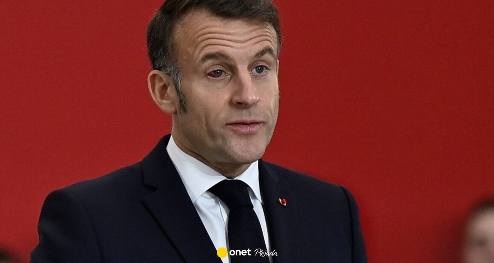 Emmanuel Macron zaniepokoił przekrwionym okiem. Wiadomo, co się stało
