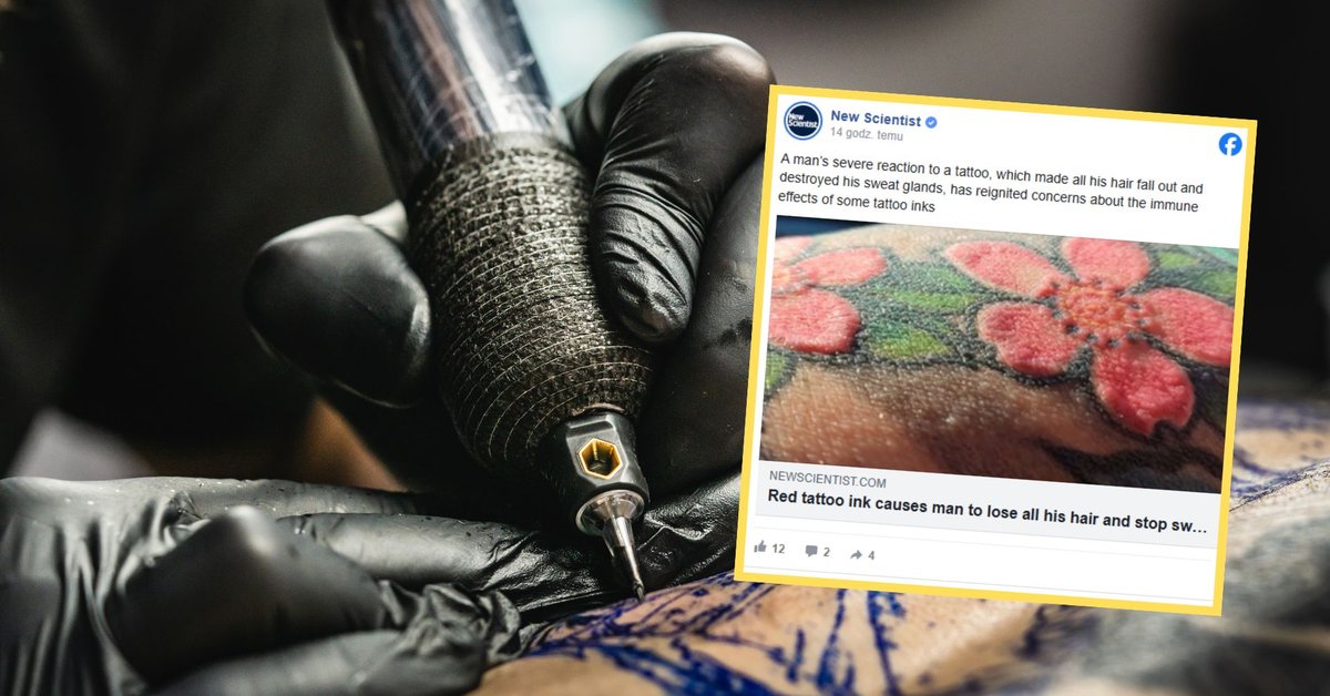36-letni Polak zrobił sobie tatuaż. Stracił włosy i zdolność pocenia się