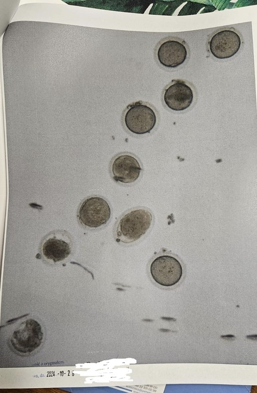 Obraz oocytów chwilę po rozmrożeniu