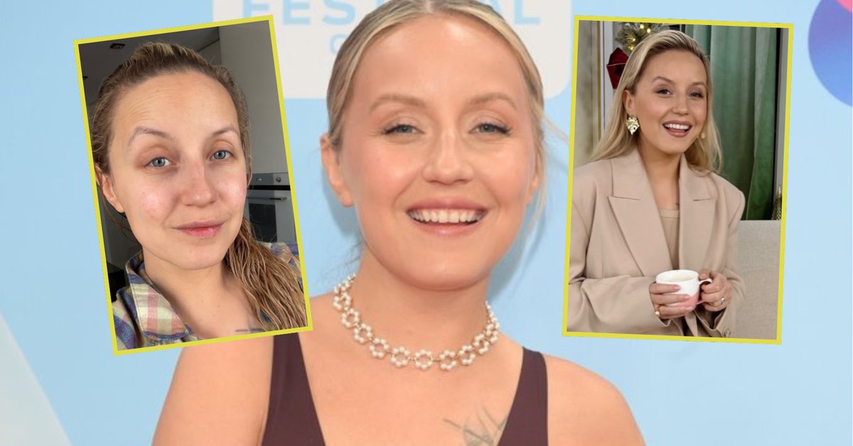 Sandra Hajduk o poddawaniu się operacjom plastycznym. "Taka jest prawda"