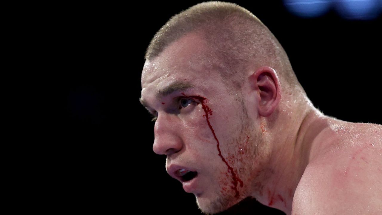 Damian Knyba - Agit Kabayel. Polak znokautowany w trzeciej rundzie [WIDEO] - sport.tvp.pl