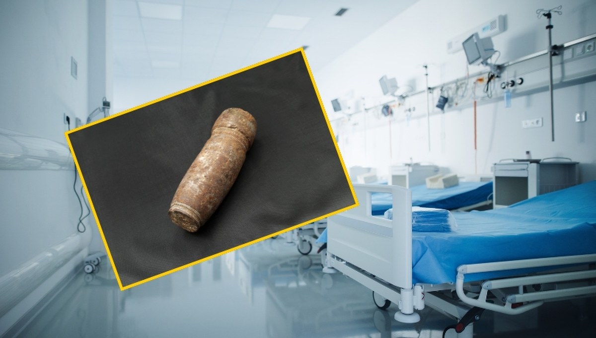 Francja. Nietypowy incydent w szpitalu w Tuluzie. Pacjent z pociskiem w odbycie