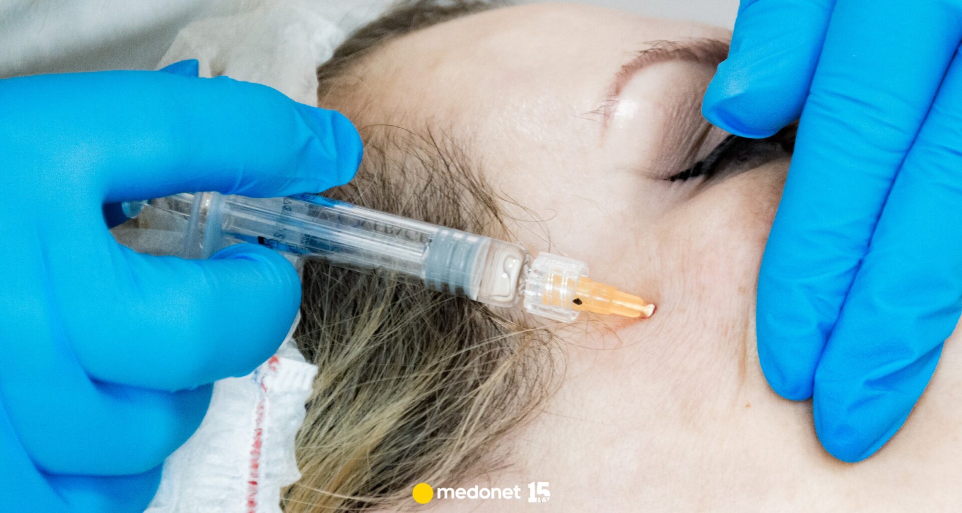 Zabiegi medycyny estetycznej tylko dla lekarzy. Kosmetolodzy oburzeni