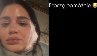 Honorata Skarbek trafiła na SOR. Pokazała niepokojące zdjęcia. 'Proszę, pomóżcie' - Plotek.pl