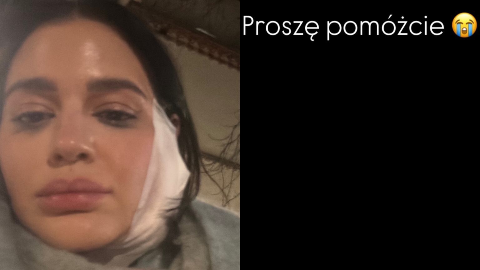 Honorata Skarbek trafiła na SOR. Pokazała niepokojące zdjęcia. 'Proszę, pomóżcie' - Plotek.pl