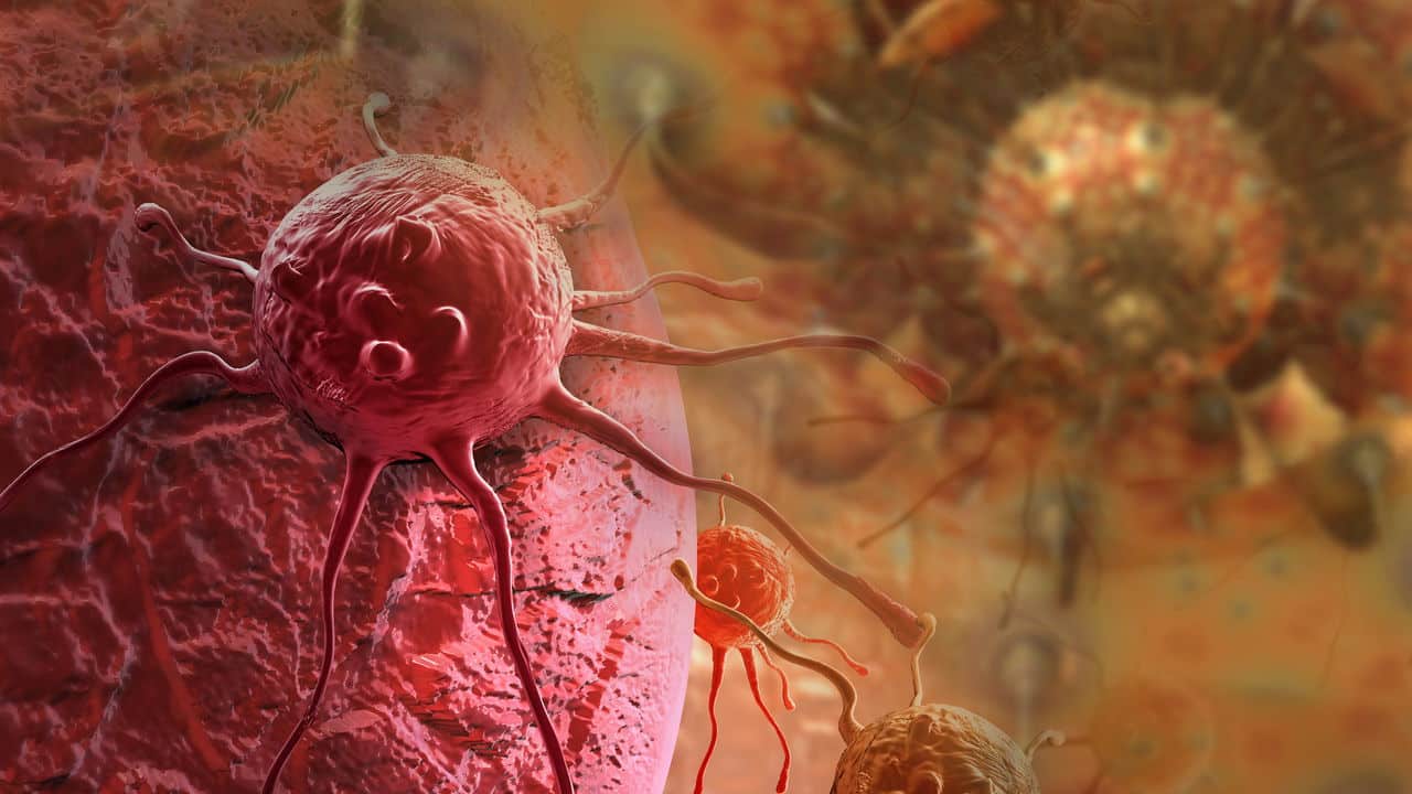 Popular no Brasil, esse alimento pode estar ligado ao câncer no intestino; veja o alerta