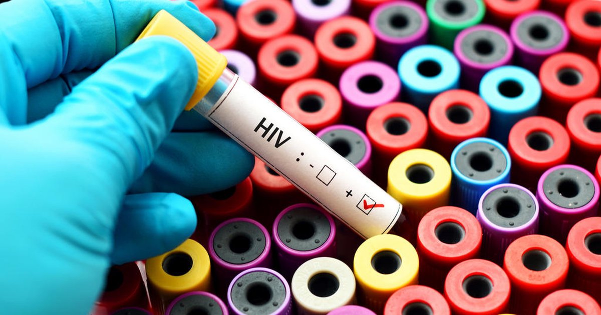 Uma pessoa a cada 50 vive com HIV no Rio Grande do Sul, mostra estudo inédito