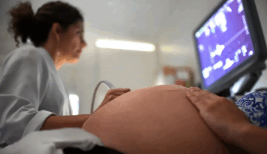 Falta de pré-natal aumenta risco de anomalias em 47%, diz estudo