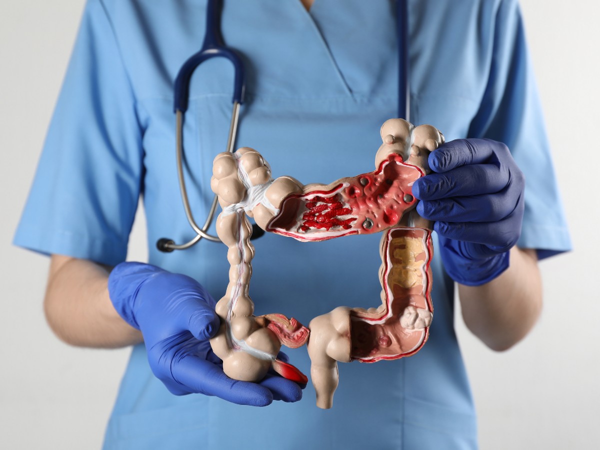 Sexto sentido intestinal? Estudo mostra como bactérias 'falam' com o cérebro