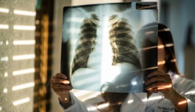 A cada 72 horas, cinco pessoas morrem por pneumonia em BH