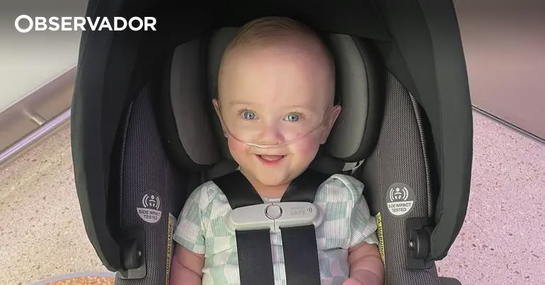 Bebé que nasceu com 21 semanas é o mais prematuro do mundo – Observador