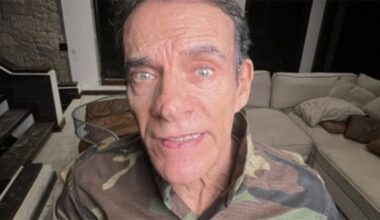 Mário Gomes realiza harmonização facial e exibe novo visual aos 72 anos