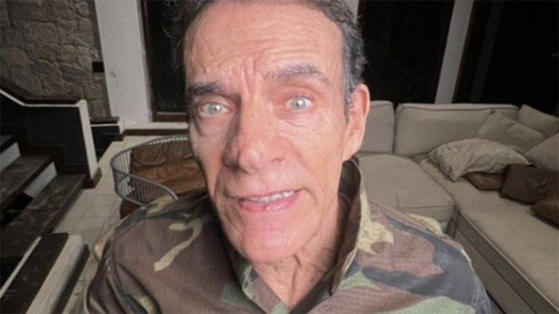 Mário Gomes realiza harmonização facial e exibe novo visual aos 72 anos