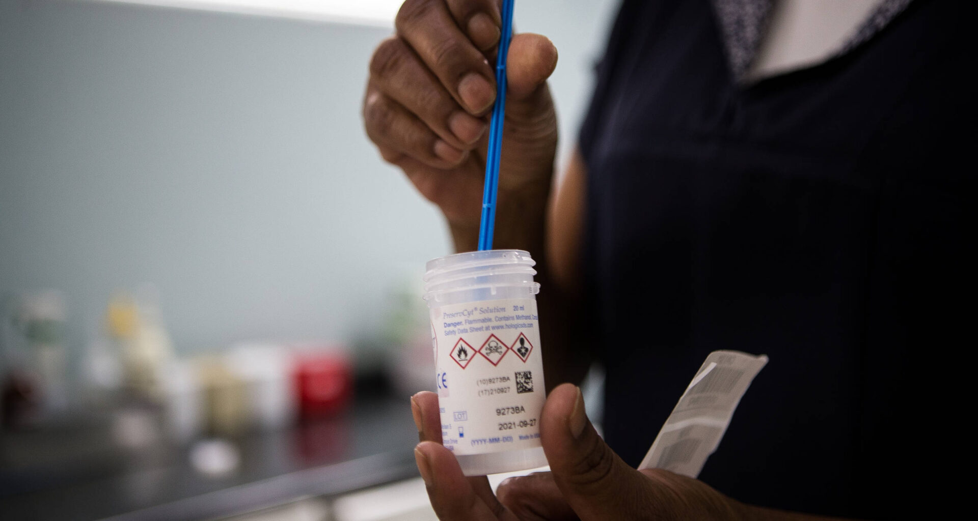 SUS expande exame de DNA que substituirá o Papanicolau - 26/08/2025 - Equilíbrio e Saúde