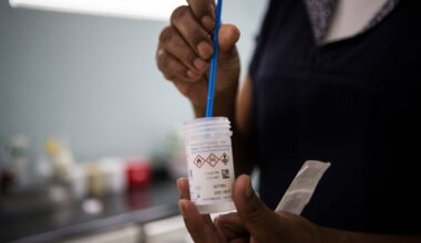 SUS expande exame de DNA que substituirá o Papanicolau - 26/08/2025 - Equilíbrio e Saúde