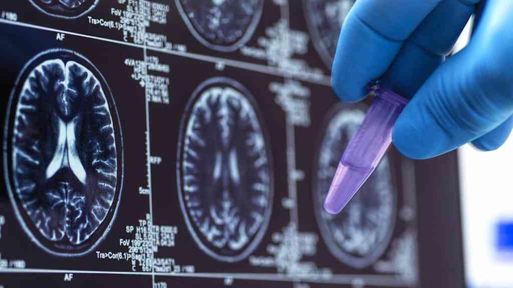 Estudo alerta para aumento de fraudes científicas com redes maliciosas