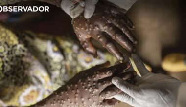Moçambique quer combater desinformação sobre Mpox – Observador